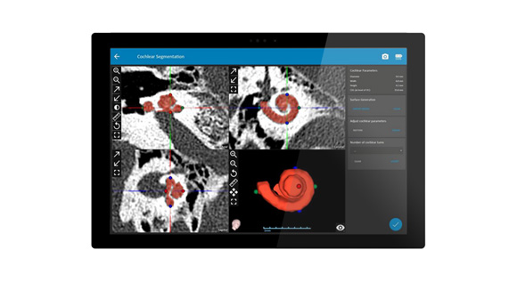 Otoplan-SurfacePro4 Otoplan-SurfacePro4