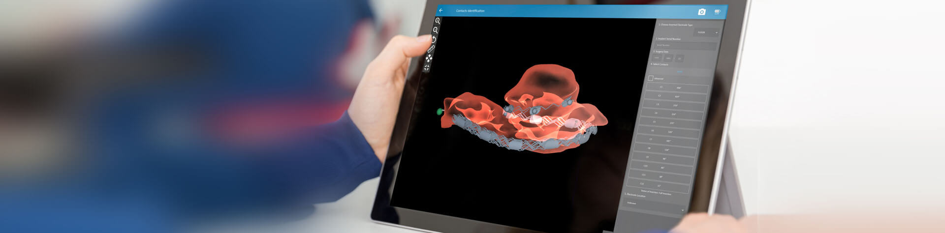 Otoplan_Bone_Thickness-4 Otoplan_Bone_Thickness-4